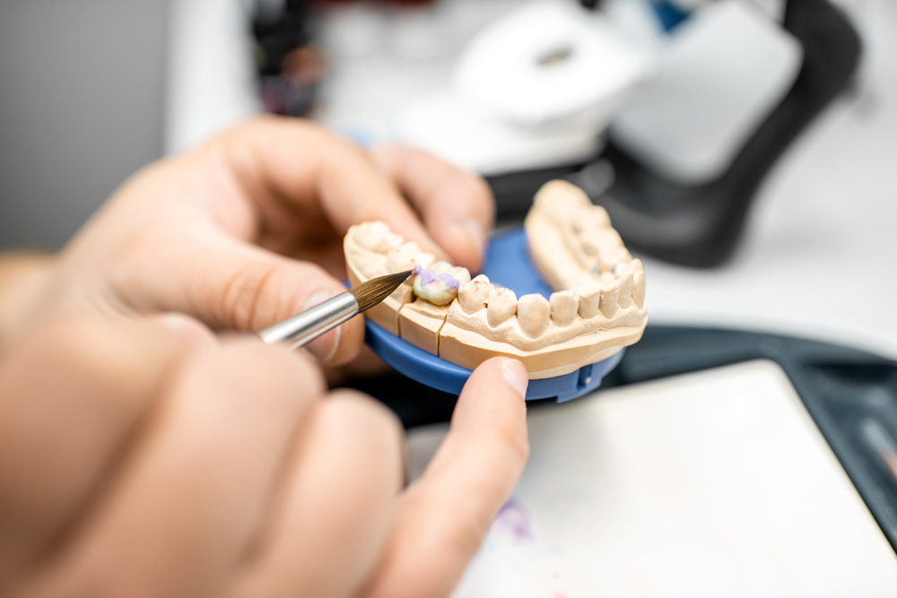 Dental Implant Restoration What You Should Know