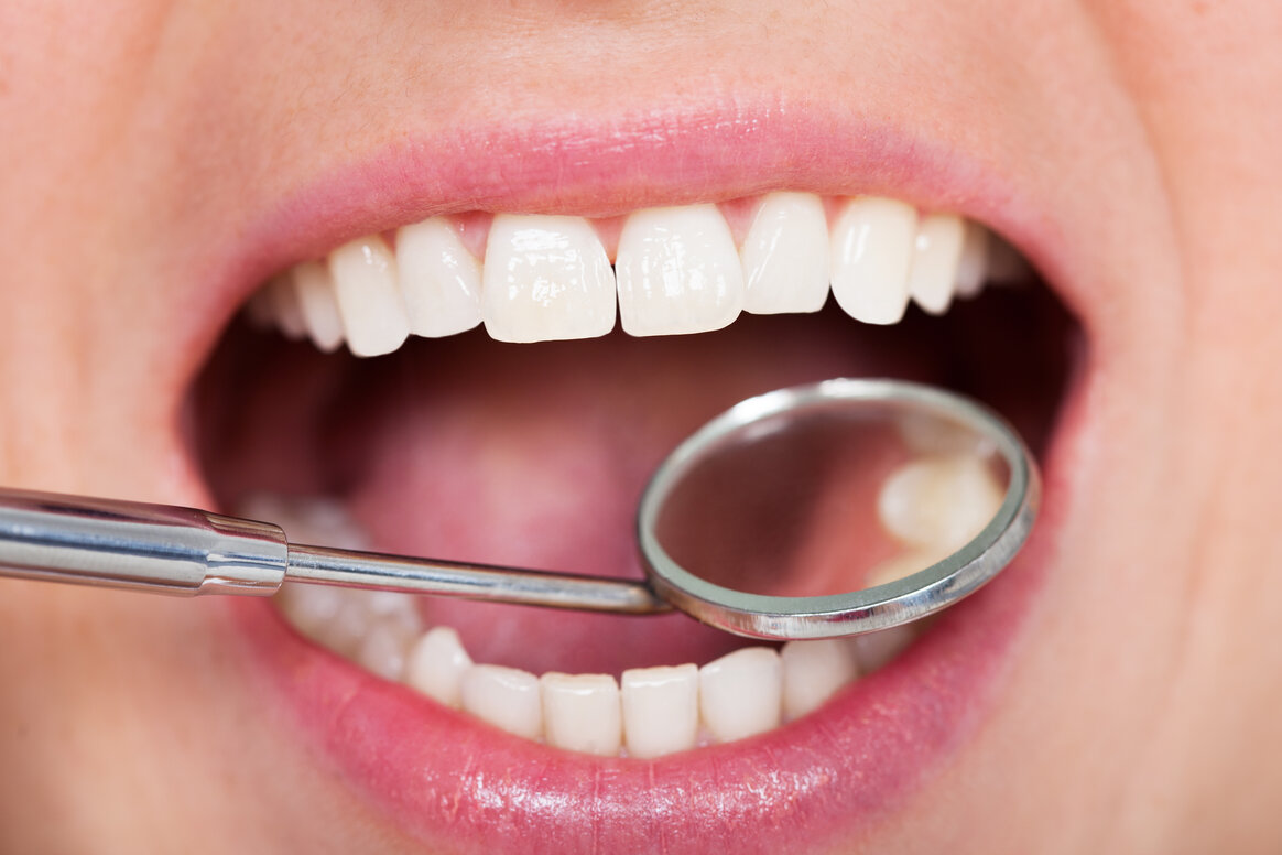 Dental Crown vs. Filling What’s the Difference?
